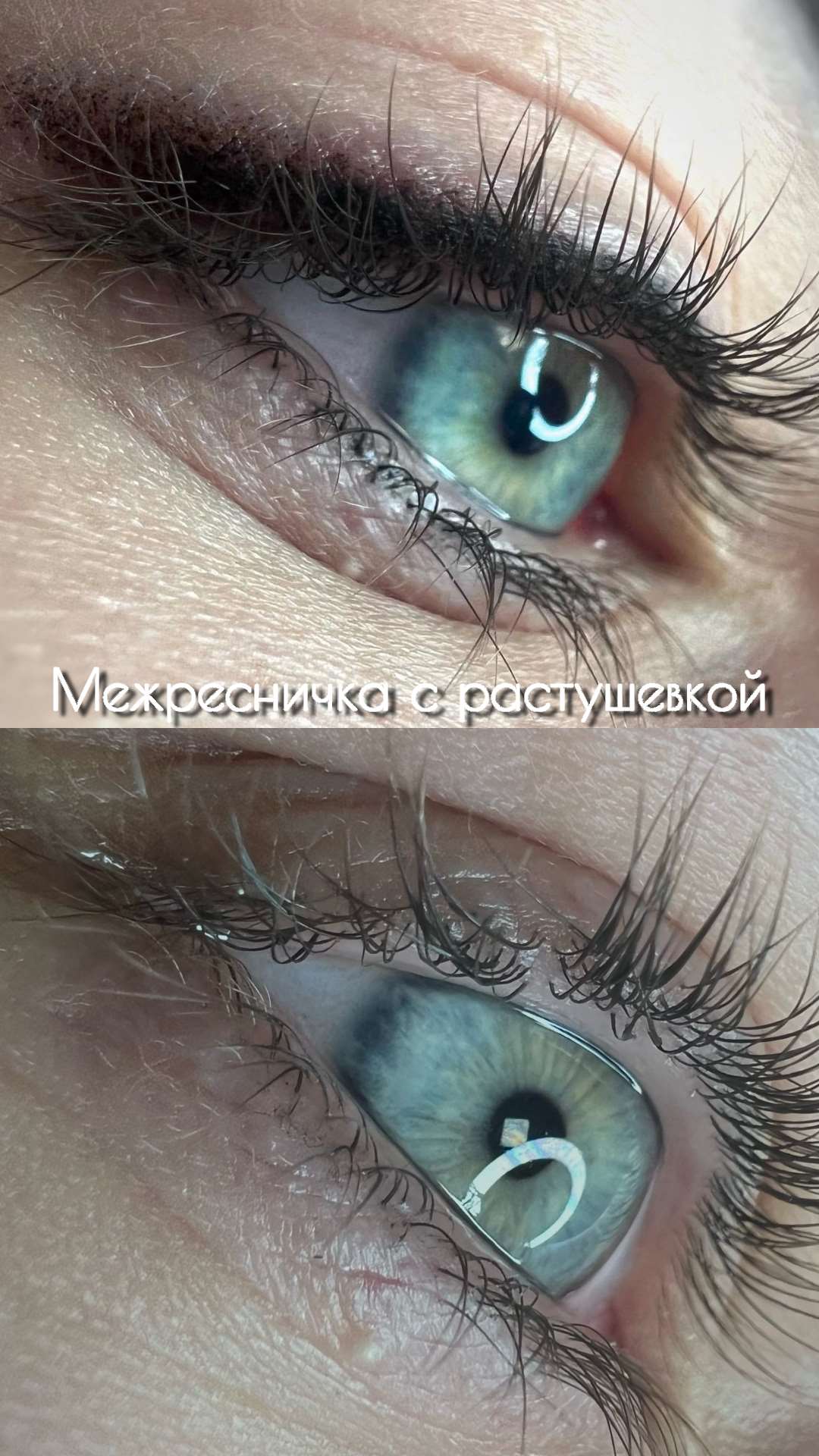 Межресничка